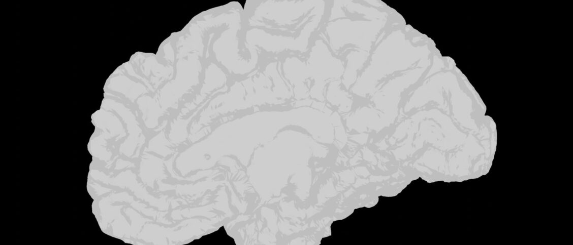 Neurodiversity in the Criminal Justice System: An Overlooked Crisis - Scott Dylan